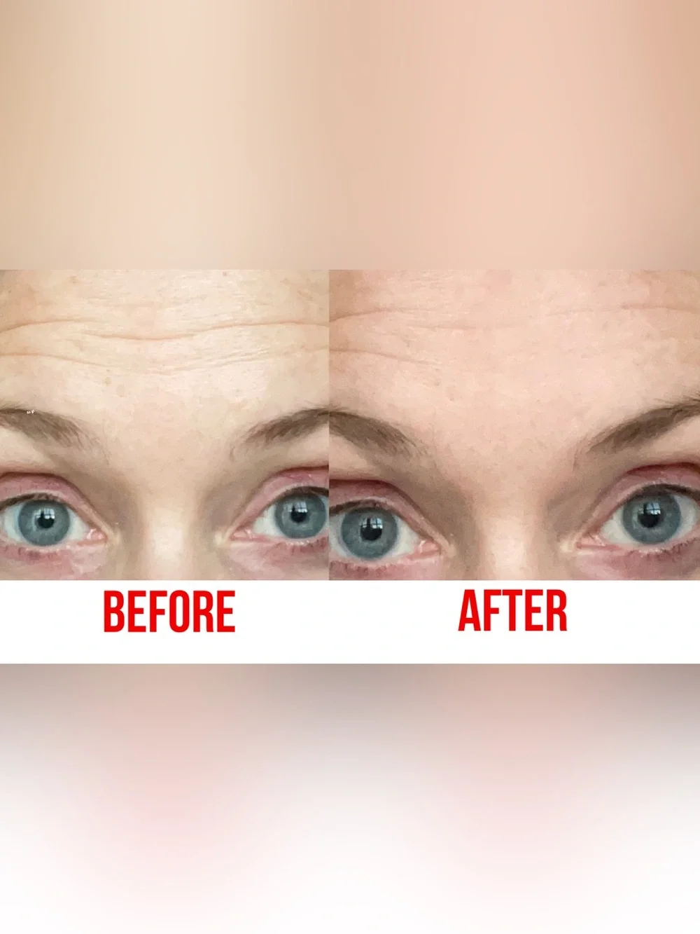 Murad Targeted Wrinkle Corrector 0.5 fl oz (15 ml) tube